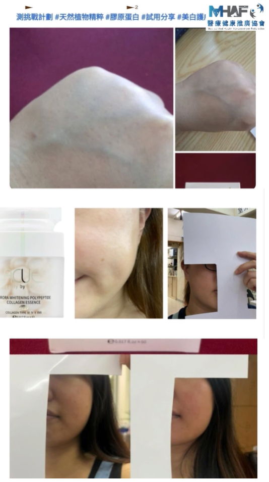 97.9%醫護推薦：LACUES 極光膠原多勝肽美白丸｜專業認證 • 傲視同群 - testimonial