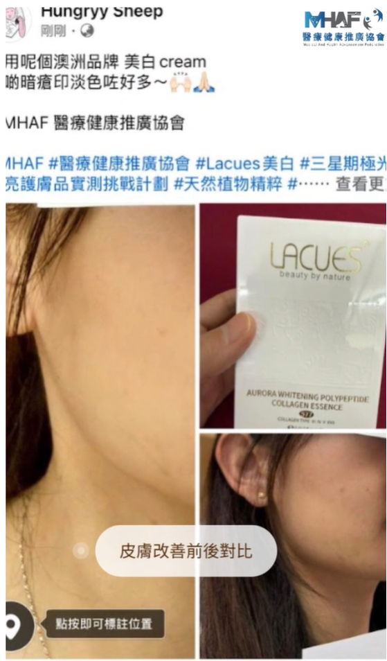 97.9%醫護推薦：LACUES 極光膠原多勝肽美白丸｜專業認證 • 傲視同群 - testimonial